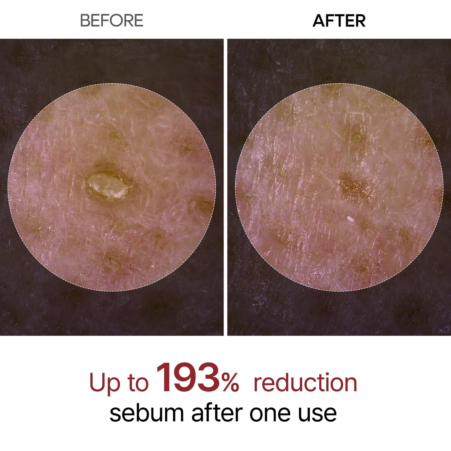 Peel Shot Glow Ampoule