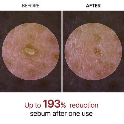 Peel Shot Glow Ampoule